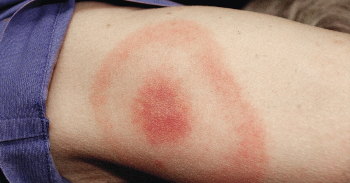 A Nonspecific Diagnosis