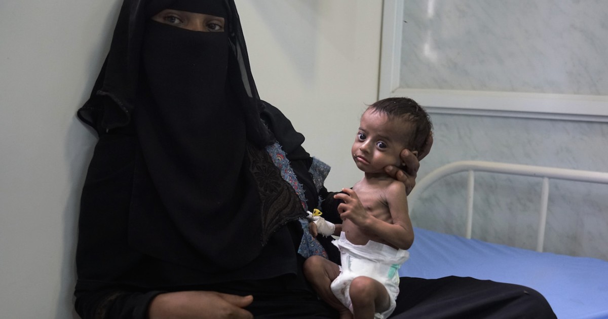 America's Balancing Act in Yemen