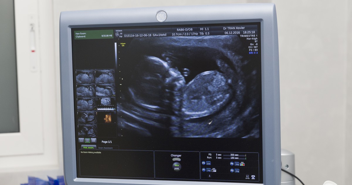 Scott Walker's Dem Opponent: Tax Dollars Should Pay for Abortions Just Like They Pay for Tonsillectomies