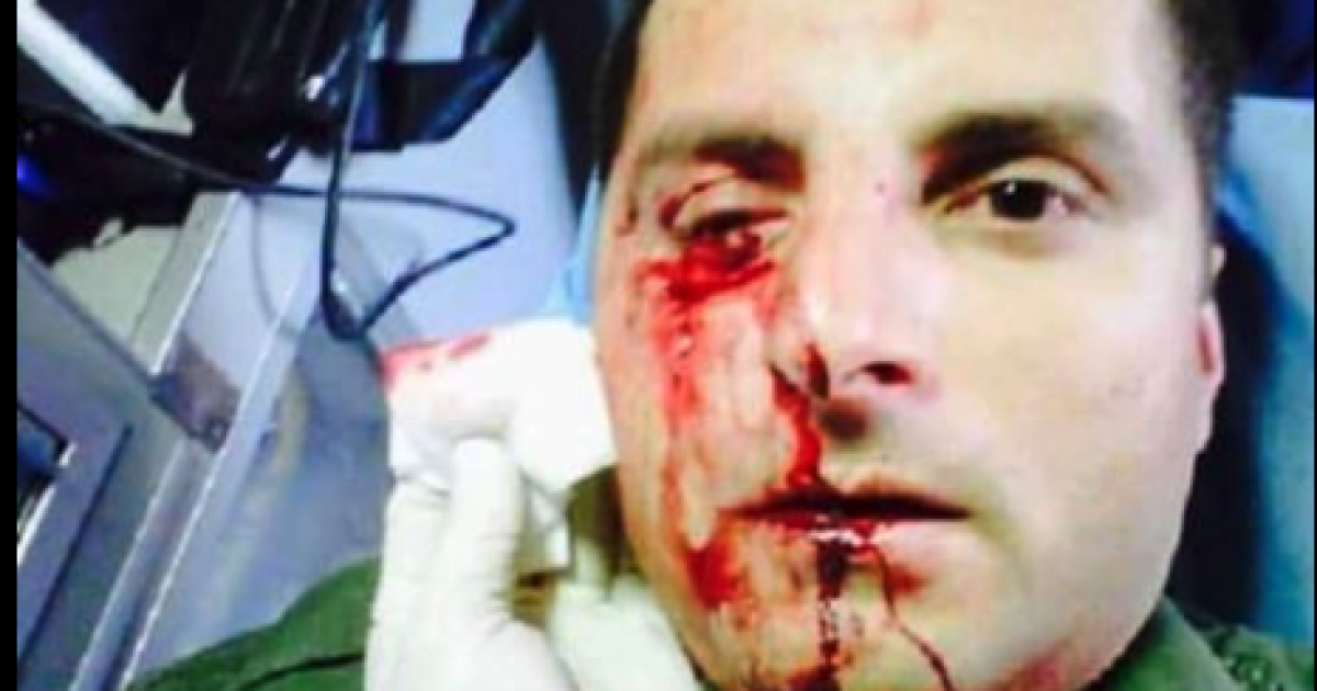Fact Check: Does a Photo Show a Border Agent Attacked by the Current Migrant Caravan?
