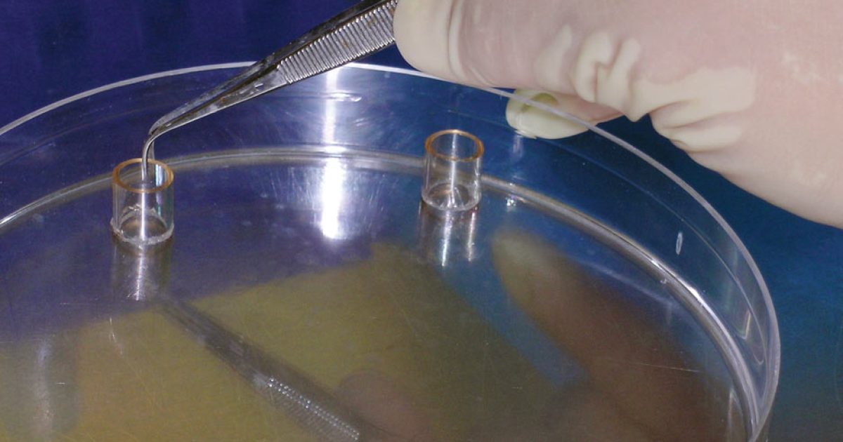 The Arrival of Human Cloning